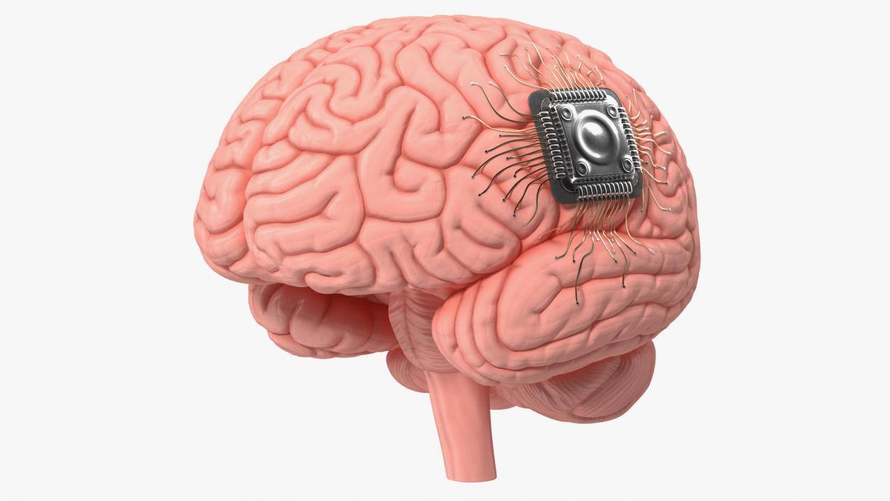 3D Human Brain with Implanted Microchip 2 model