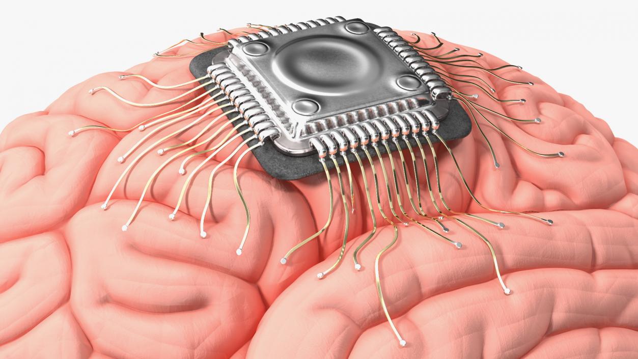 3D Human Brain with Implanted Microchip 2 model