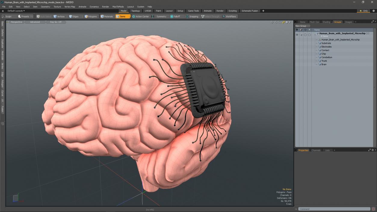 3D Human Brain with Implanted Microchip 2 model