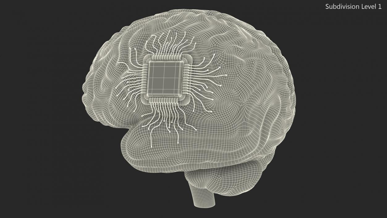 3D Human Brain with Implanted Microchip 2 model