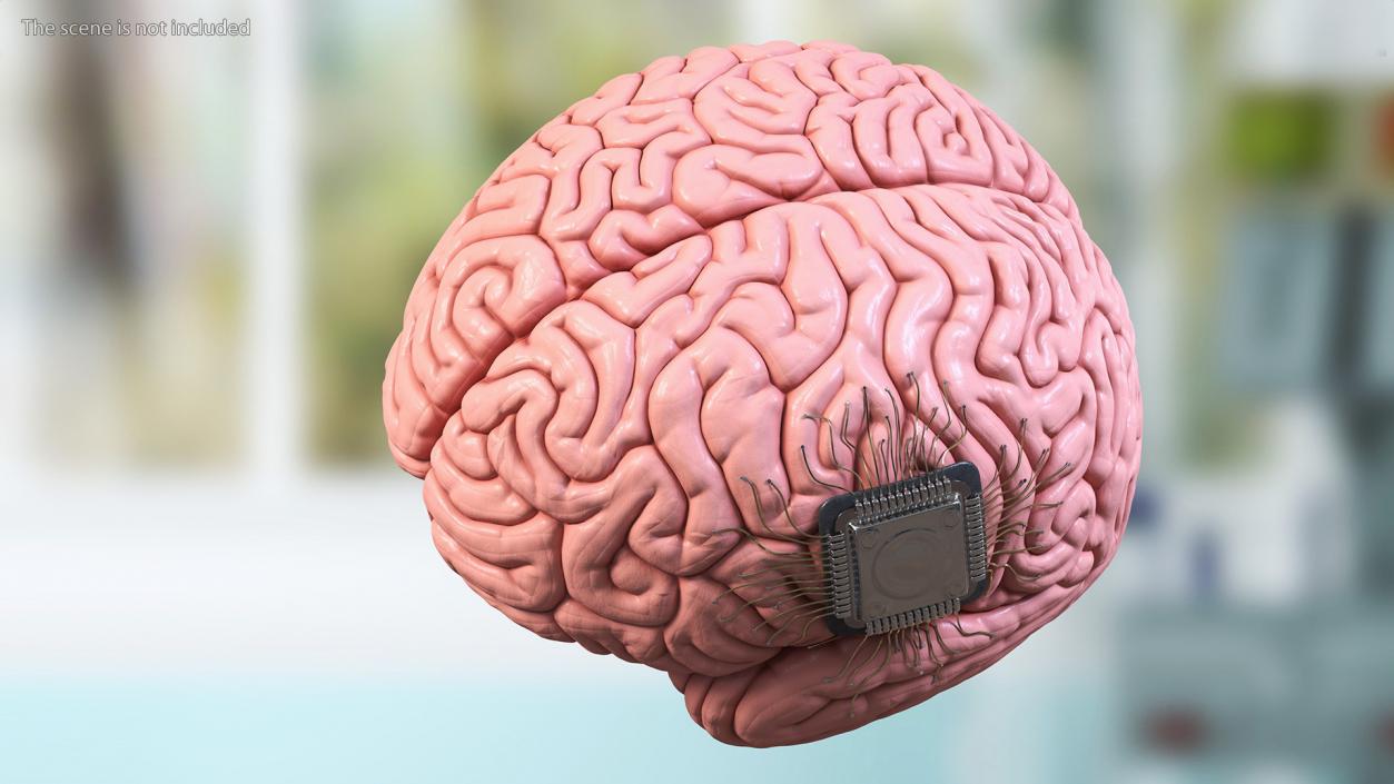 3D Human Brain with Implanted Microchip 2 model