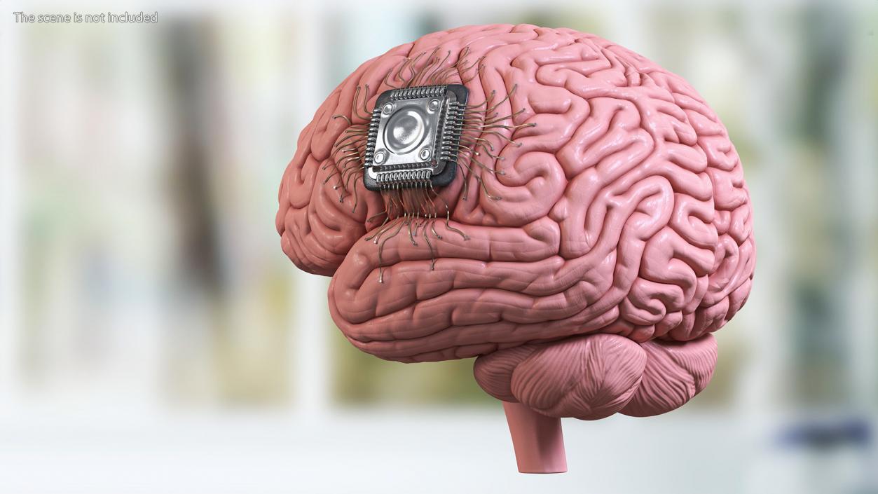 3D Human Brain with Implanted Microchip 2 model