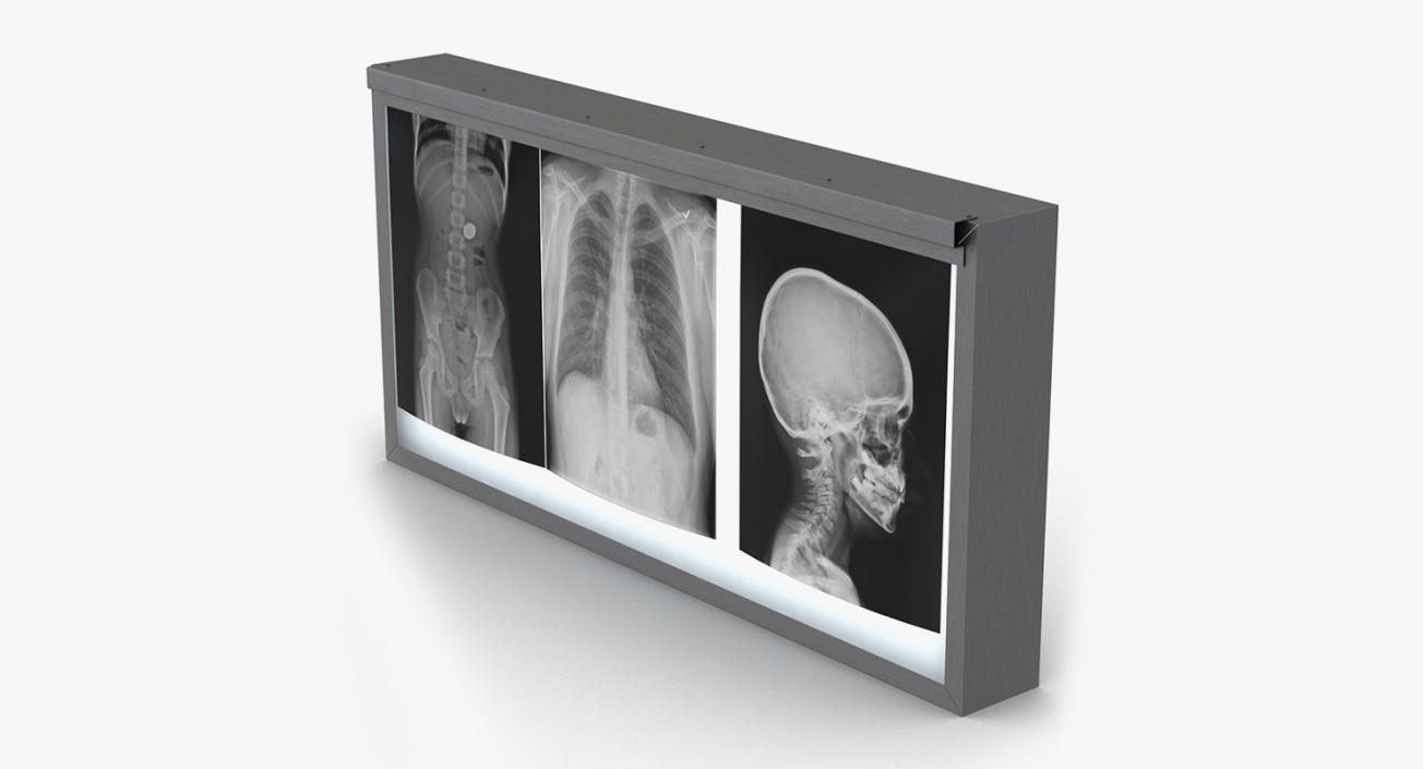 X-Ray Systems Collection 3D model