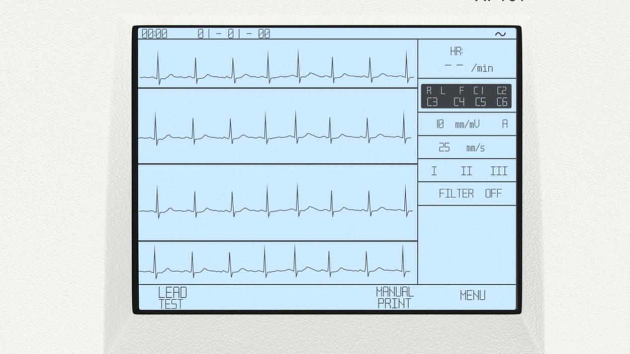 3D ECG Machine