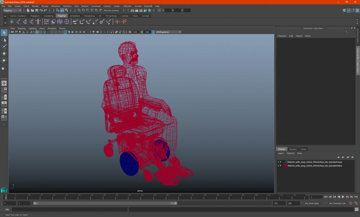 3D Patient with Jazzy Select Wheelchair