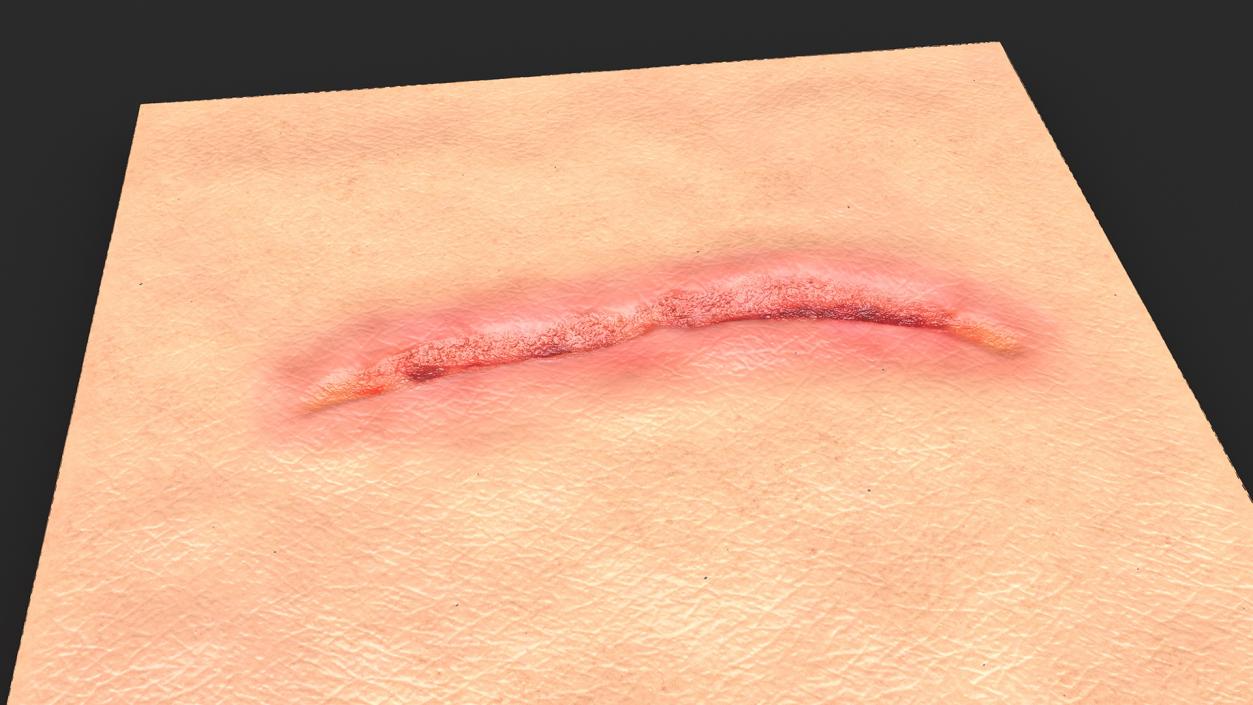 3D Cut Skin Surface