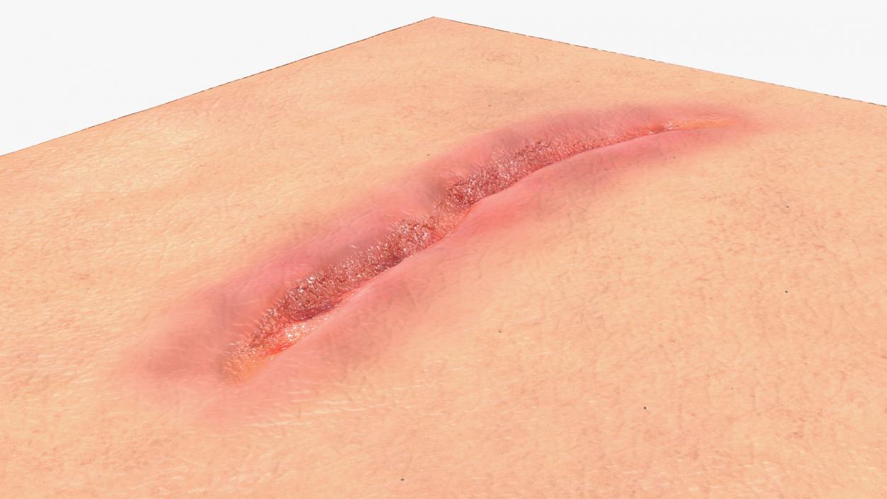 3D Cut Skin Surface