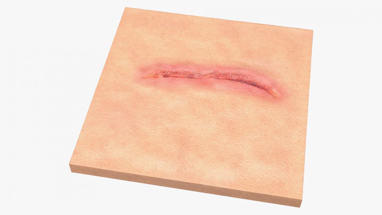 3D Cut Skin Surface