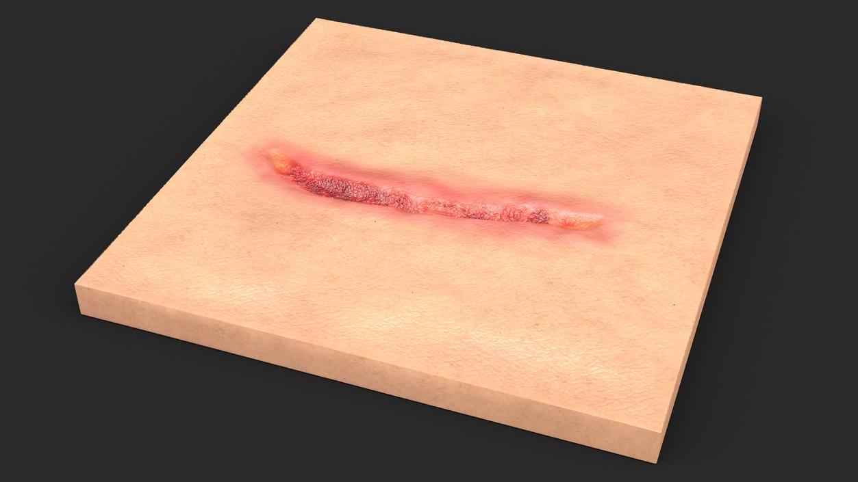 3D Cut Skin Surface