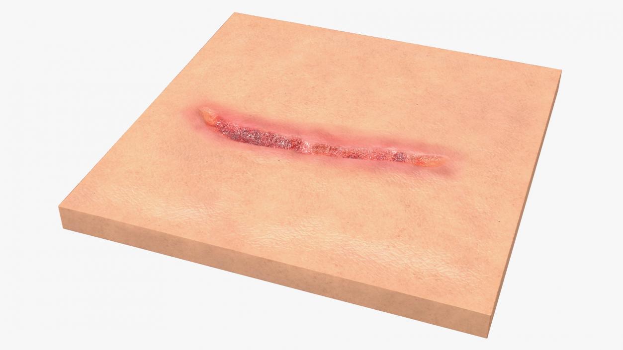 3D Cut Skin Surface