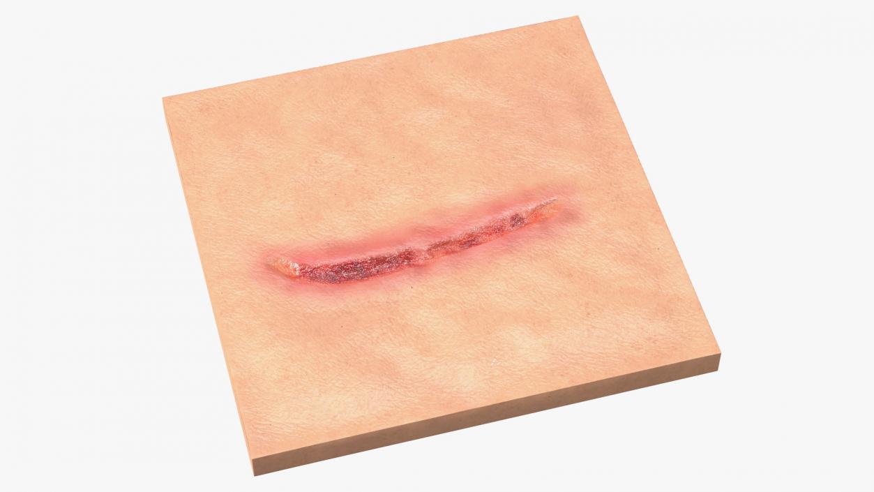 3D Cut Skin Surface