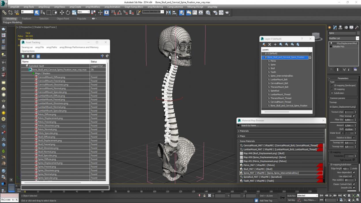 3D model Bone Skull and Cervical Spine Fixation 2