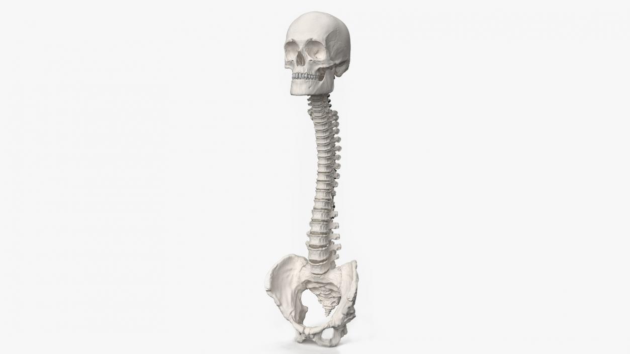 3D model Bone Skull and Cervical Spine Fixation 2