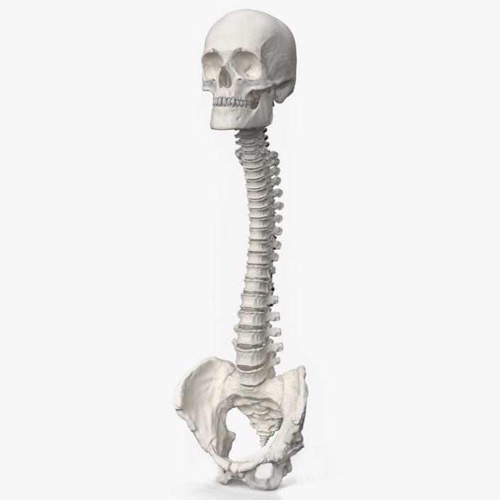 3D model Bone Skull and Cervical Spine Fixation 2