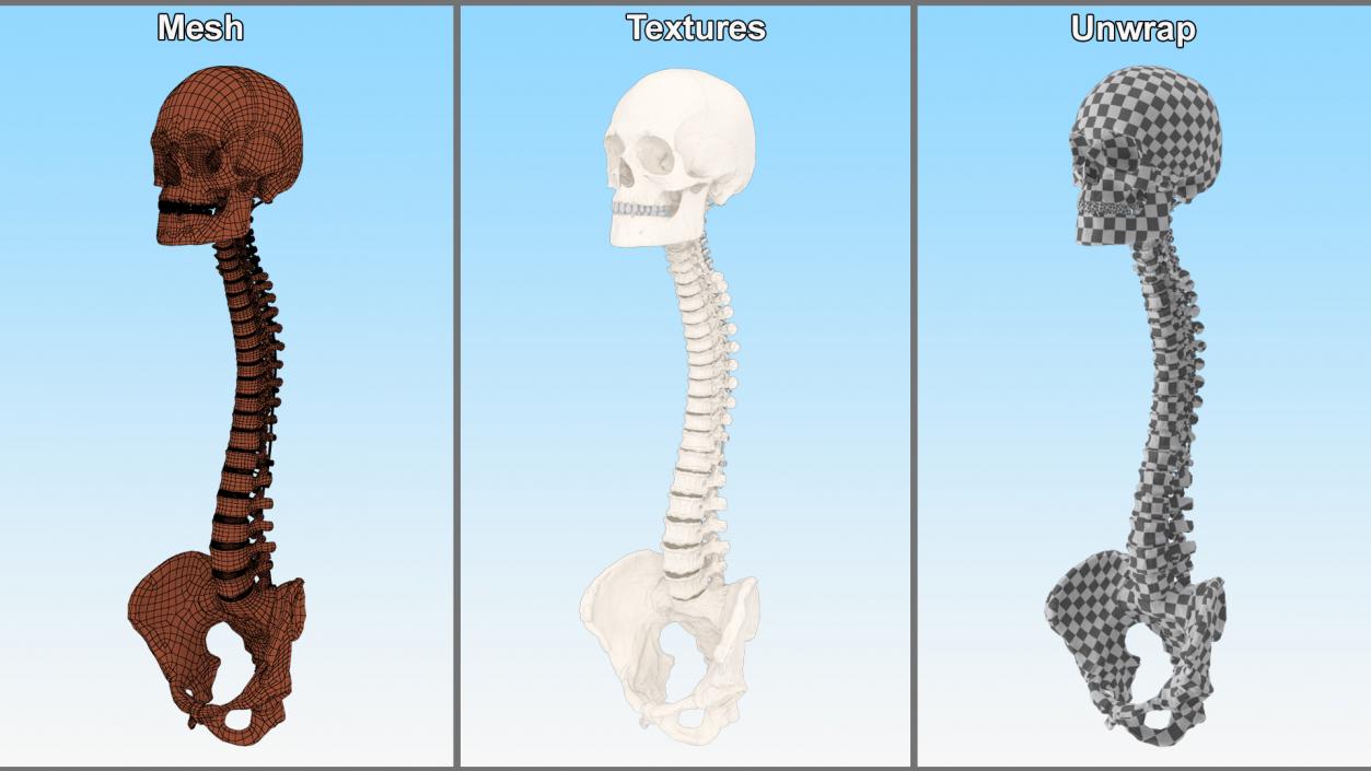 3D model Bone Skull and Cervical Spine Fixation 2