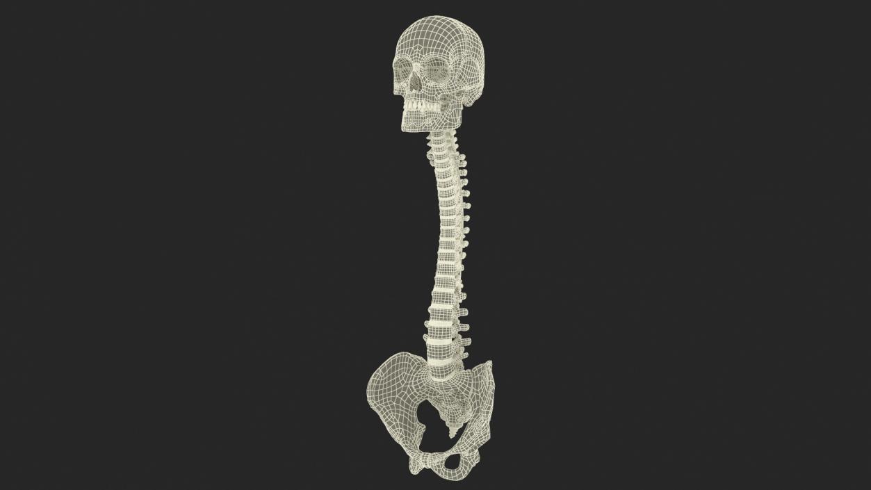 3D model Bone Skull and Cervical Spine Fixation 2