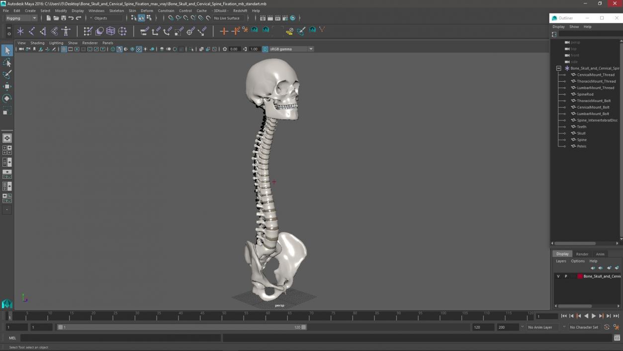 3D model Bone Skull and Cervical Spine Fixation 2