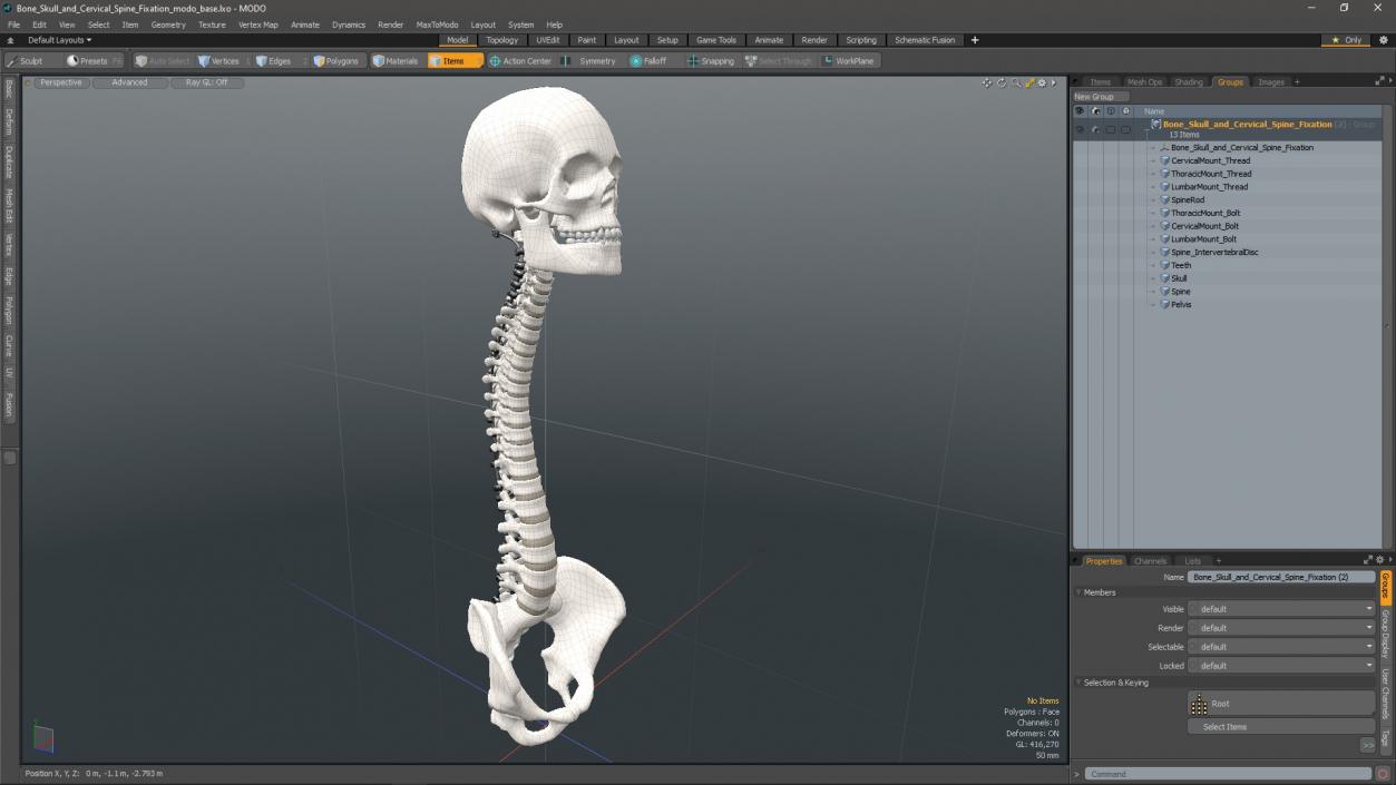 3D model Bone Skull and Cervical Spine Fixation 2