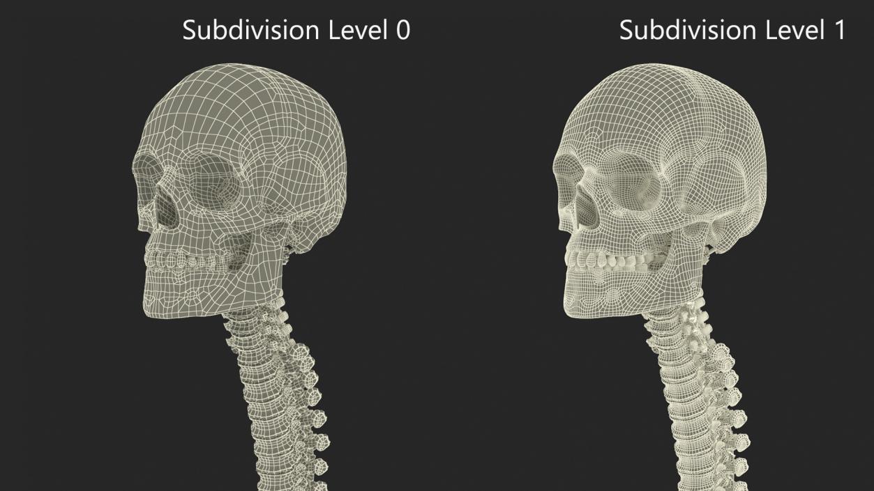 3D model Bone Skull and Cervical Spine Fixation 2