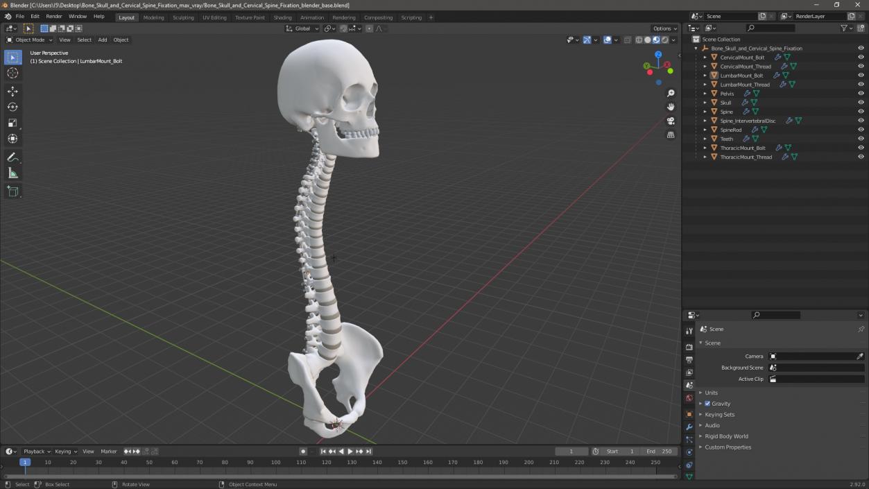 3D model Bone Skull and Cervical Spine Fixation 2