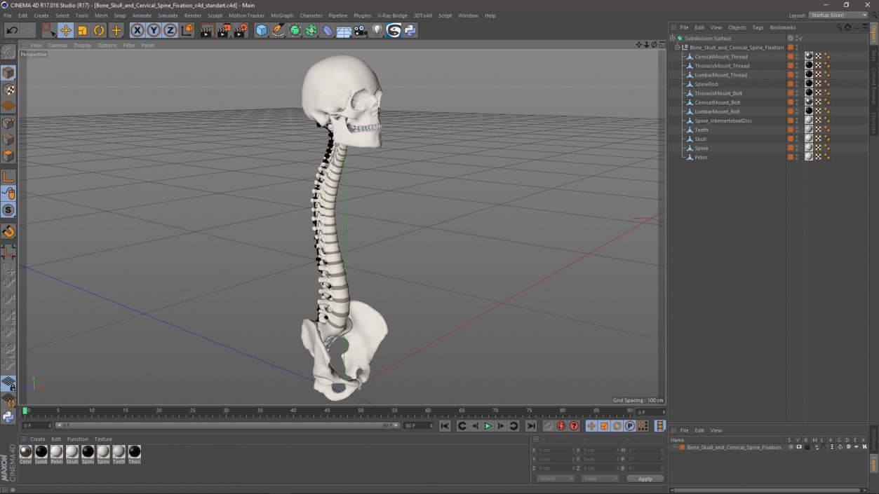 3D model Bone Skull and Cervical Spine Fixation 2