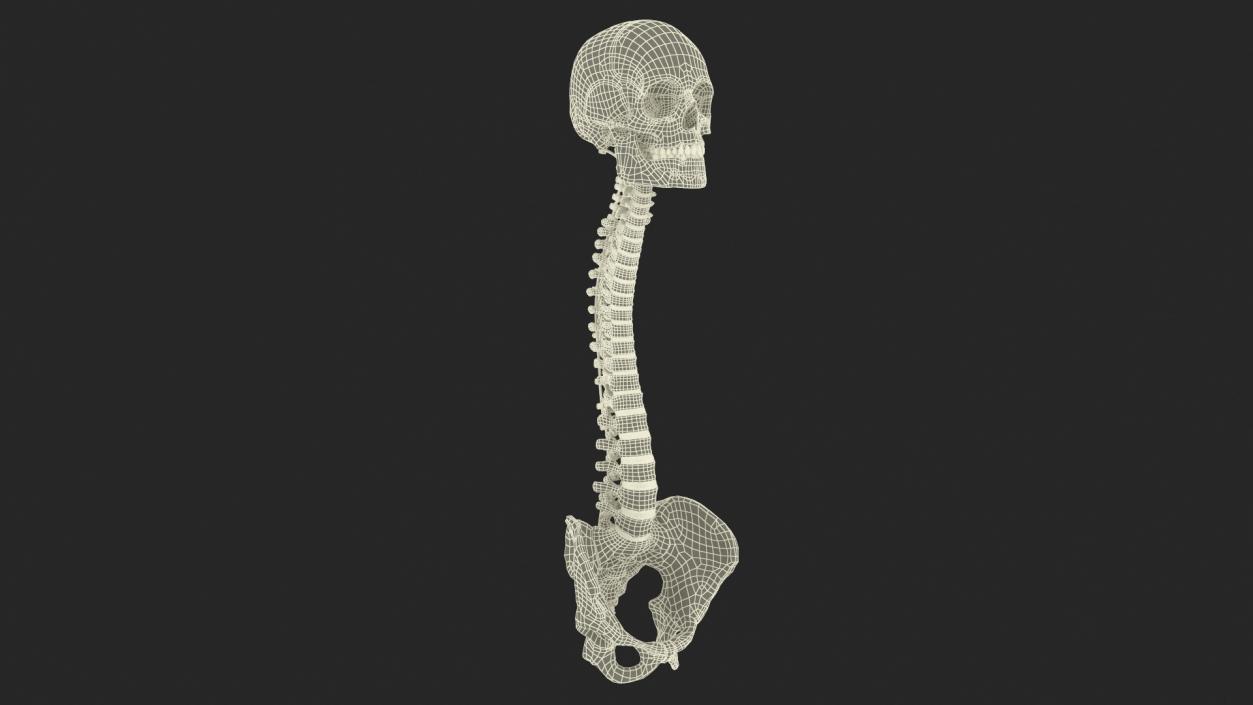 3D model Bone Skull and Cervical Spine Fixation 2