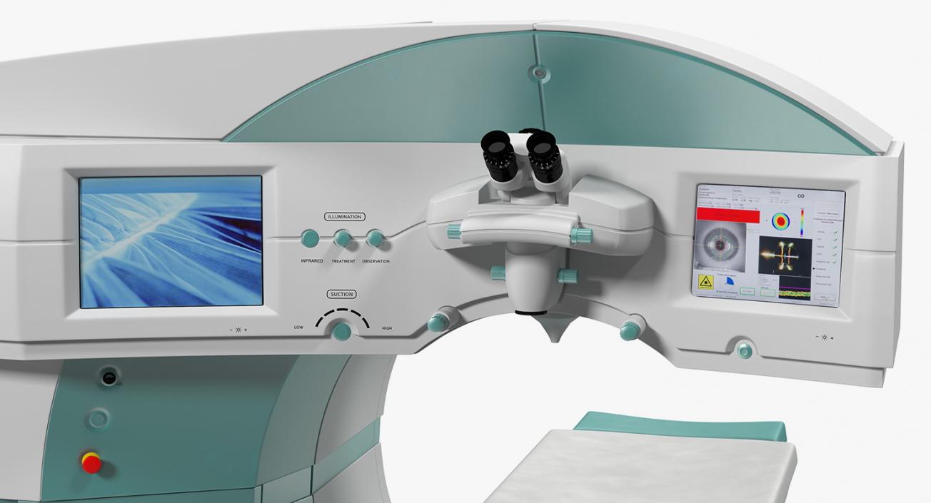 3D model Laser Vision Correction System