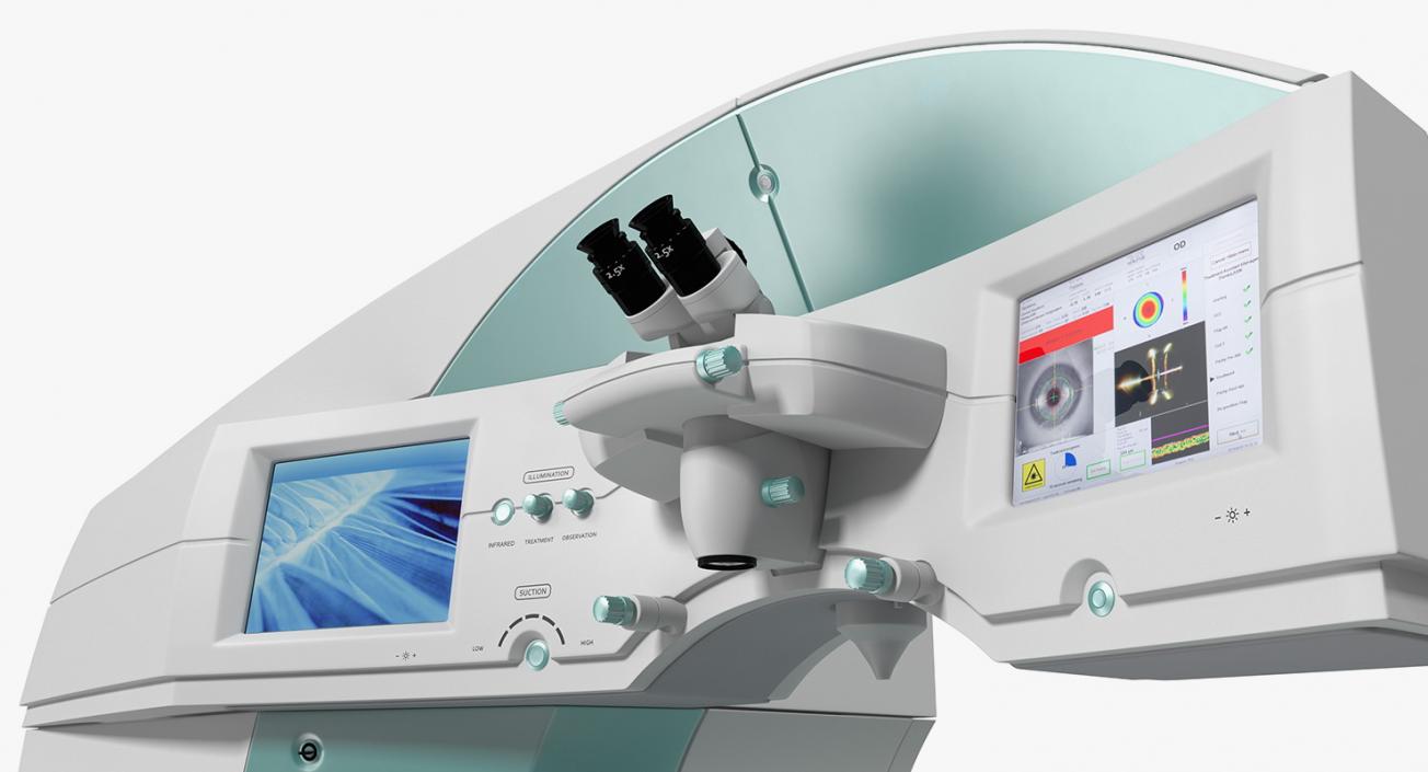 3D model Laser Vision Correction System