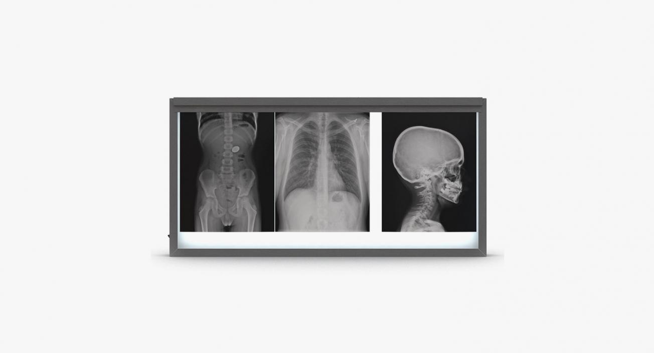 3D X-Ray Systems Collection 2