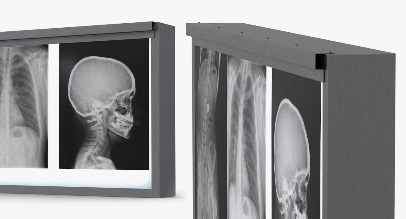 3D X-Ray Systems Collection 2