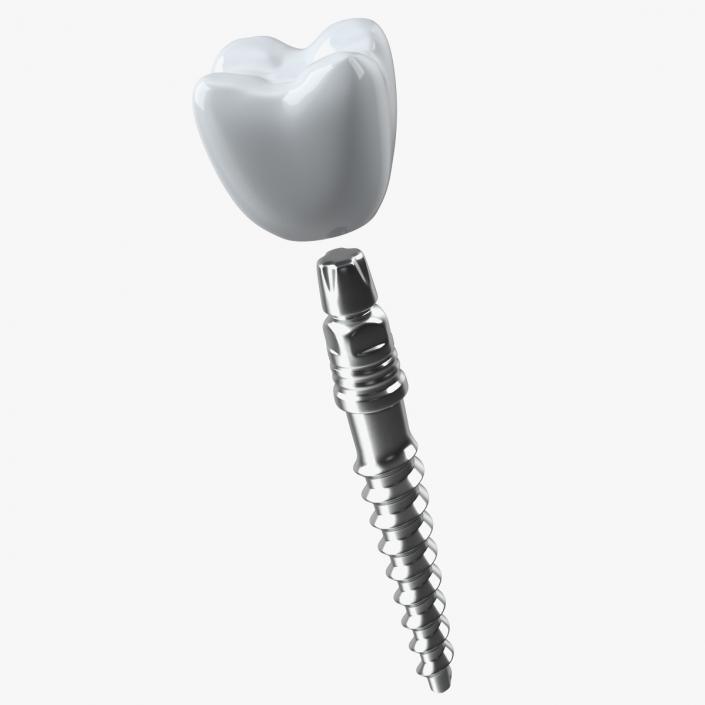 3D KOS Series Dental Implants