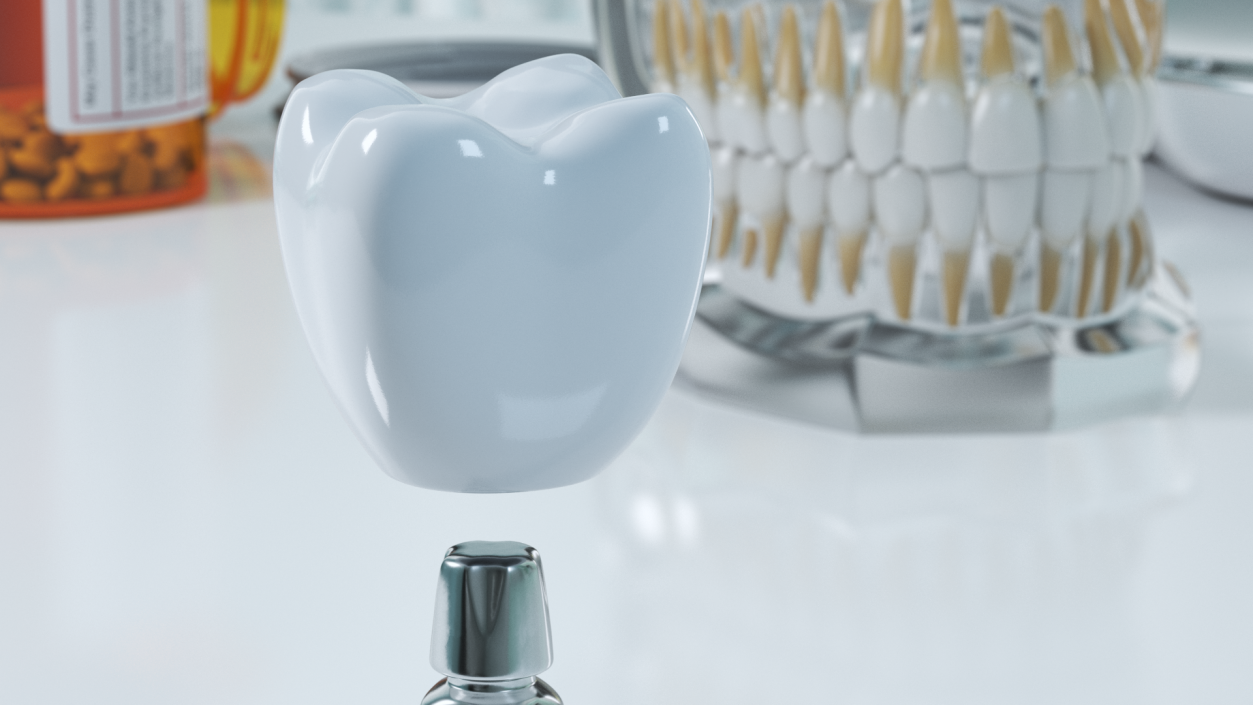 3D KOS Series Dental Implants