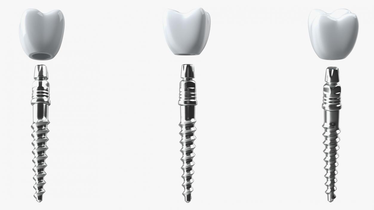 3D KOS Series Dental Implants