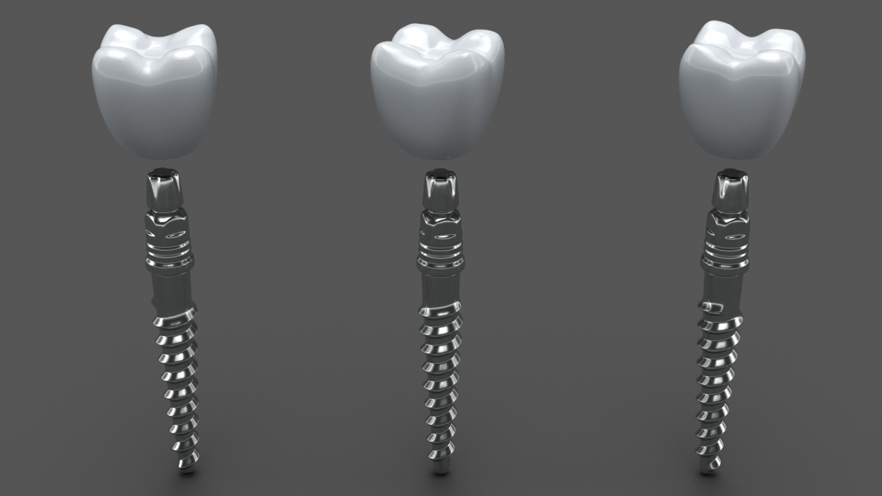 3D KOS Series Dental Implants