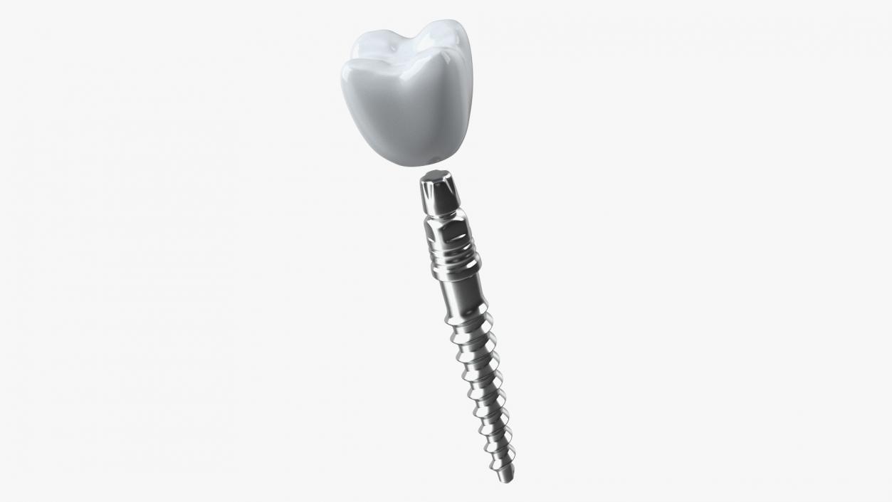 3D KOS Series Dental Implants