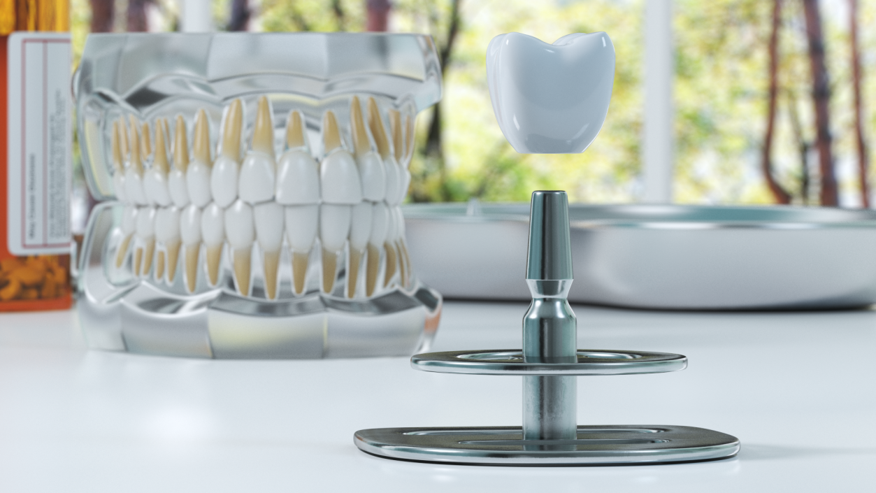 TOI Dental Implants 3D model