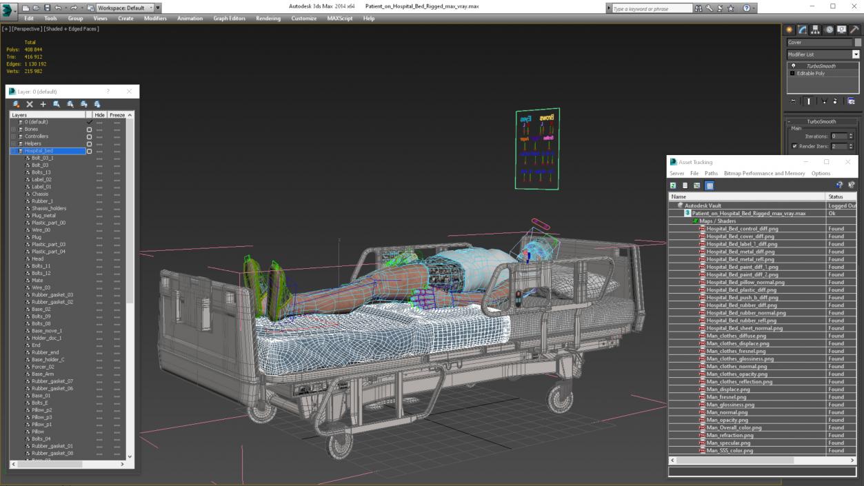 3D model Patient on Hospital Bed Rigged