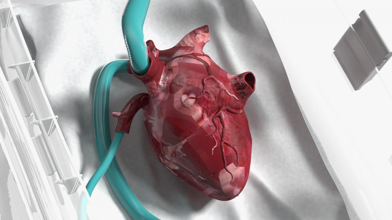 3D Heart in Organ Care Box model