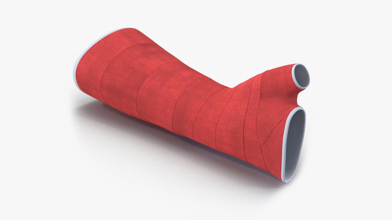 3D Orthopedic Casts Arm Collection