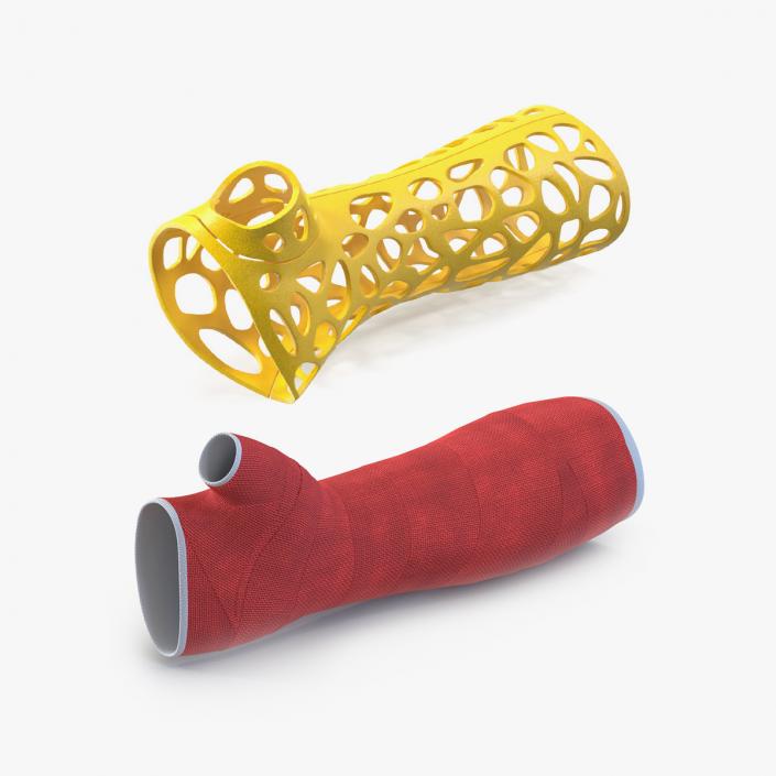 3D Orthopedic Casts Arm Collection