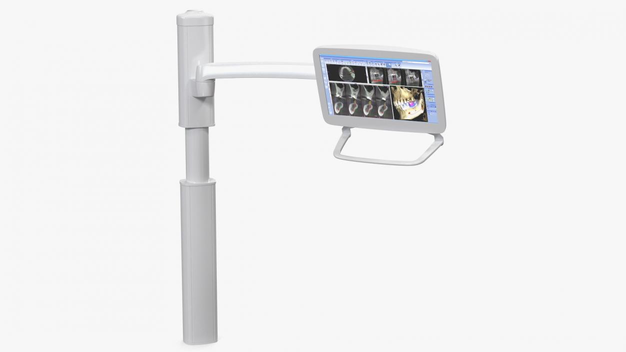 3D Post Mounted Dental LCD Display