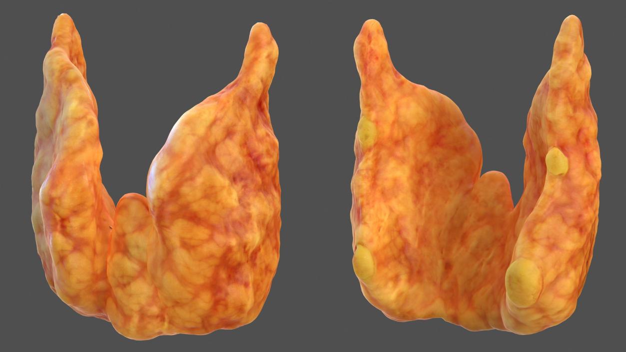 3D Human Thyroid model