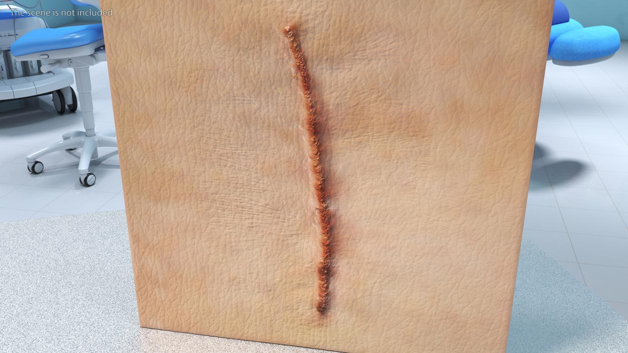 Medical Suture Closed on Skin 3D model