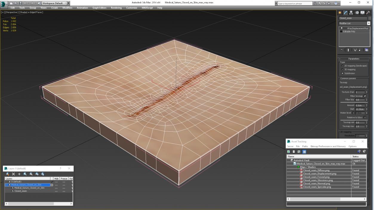 Medical Suture Closed on Skin 3D model