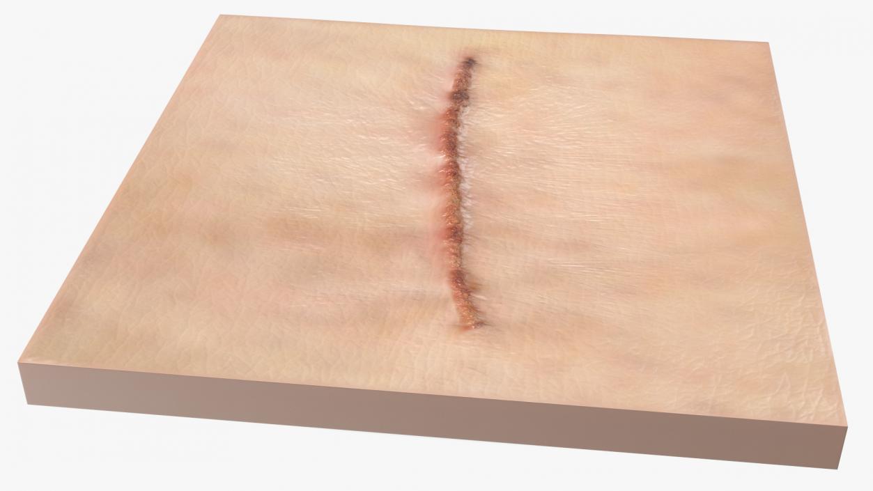 Medical Suture Closed on Skin 3D model