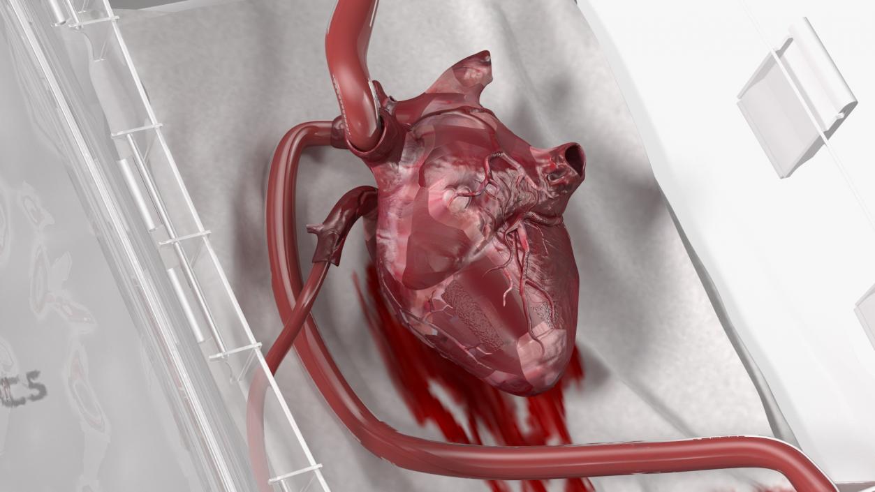 3D model Transmedics Organ Care System with Heart