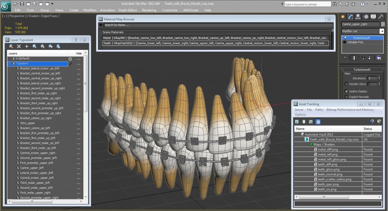 3D Teeth with Braces Model model