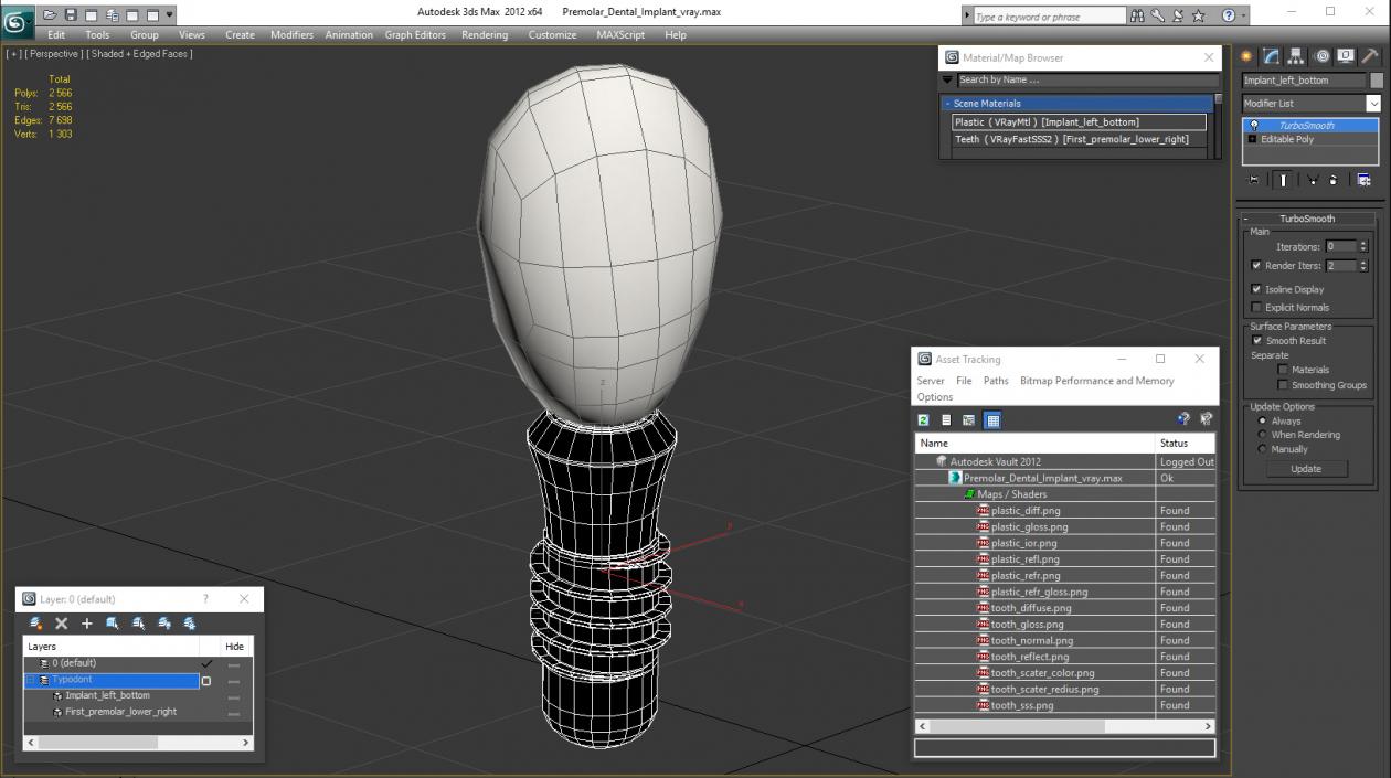 3D Premolar Dental Implant model