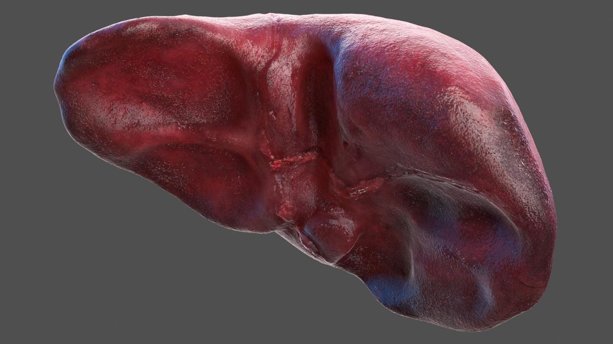 3D Human Liver