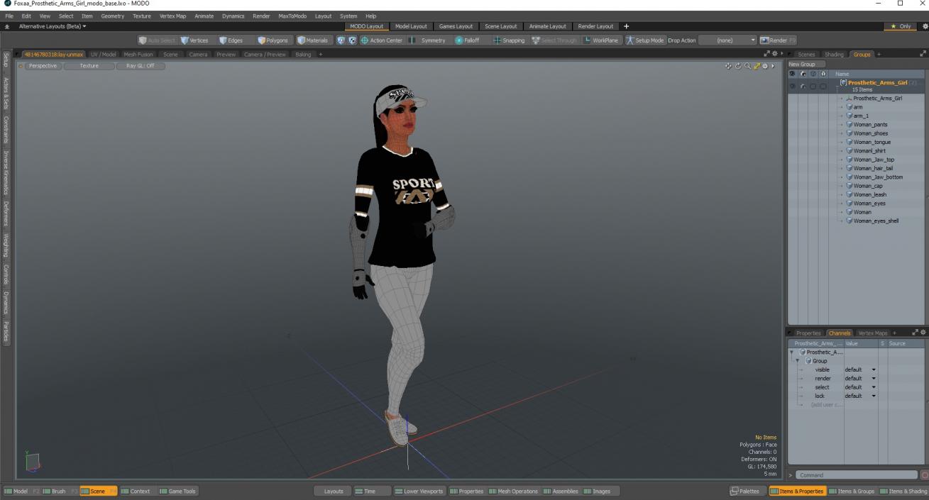 3D model Prosthetic Arms Girl